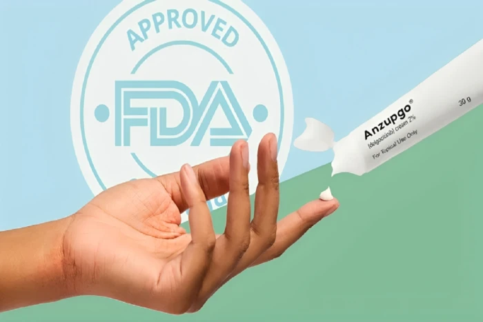 فعال وآمن ويقلل من الحكة خلال أيام ....طرح كريم جديد لعلاج الأكزيما في بريطانيا