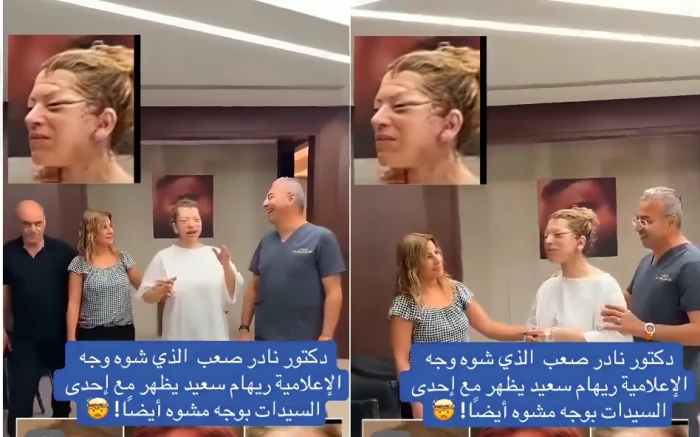 بعد الإعلامية ريهام سعيد.. بالفيديو: الدكتور نادر صعب يوثق نتيجة غريبة لعملية تجميل لوجه مريضة