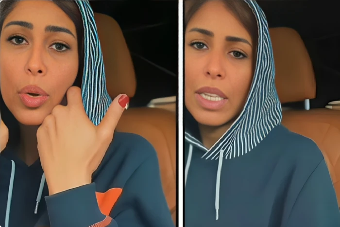 بالفيديو.. مختصة تكشف سبب الإصابة بالصدفية والثعلبة والإكزيما وانتشار التجاعيد وبقع البشرة..  وطريقة التخلص منها