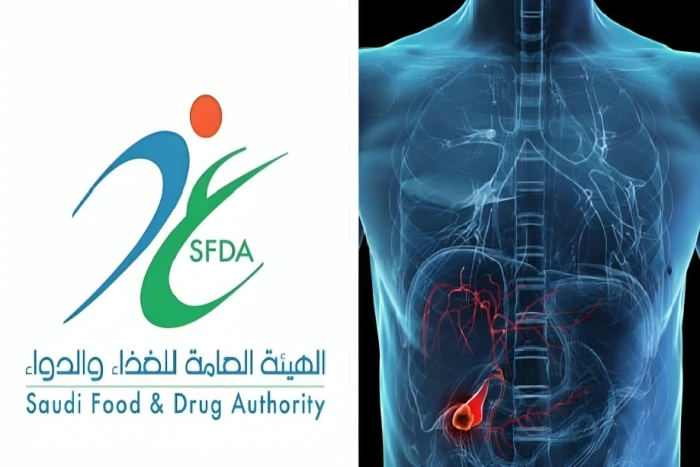 ‏"الغذاء والدواء" تعتمد تسجيل مستحضر لعلاج سرطان القنوات الصفراوية.. والكشف عن اسمه