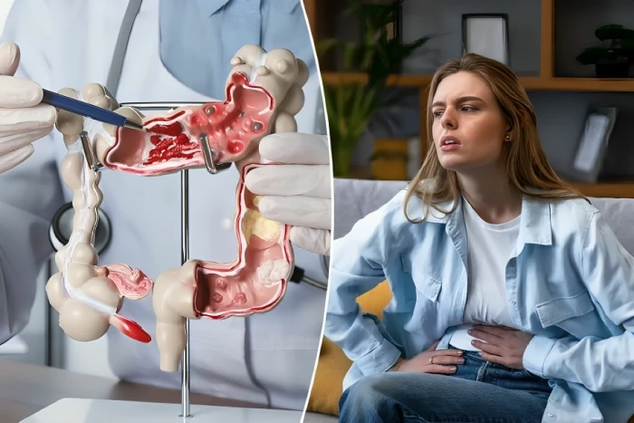 دراسة تكشف عن نوع من الأطعمة يزيد خطر الإصابة بسرطان القولون والمستقيم المبكر لدى النساء