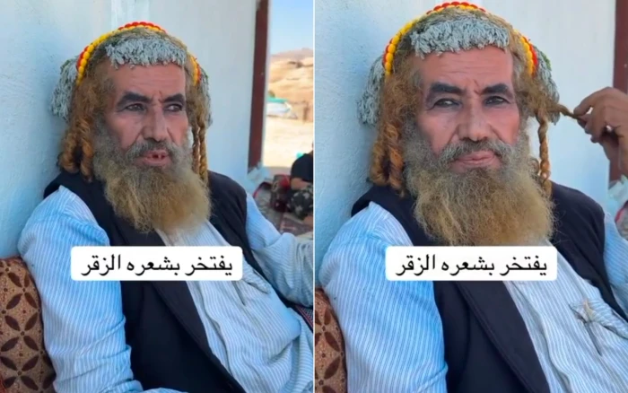 بالفيديو.. مواطن من جازان يشرح سر مظهره وشعره المضفّر: “هذه زقر من عادات القبائل”