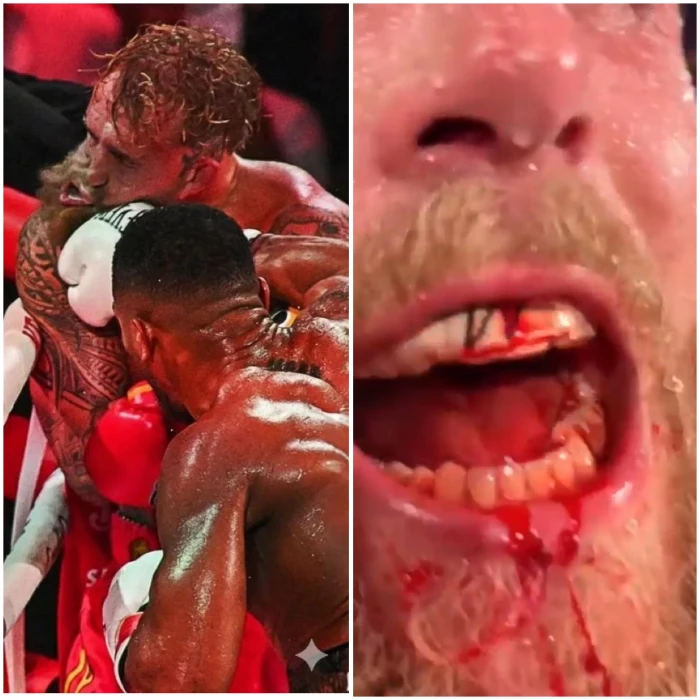 بالفيديو.. كسر فك الملاكم الأمريكي جيك بول ونقله للمستشفى بعد الخسارة أمام "جوشوا" بالضربة القاضية