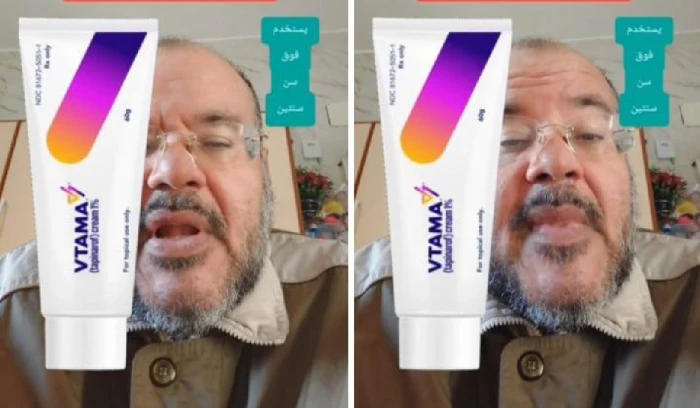 مصرح من هيئة الغذاء والدواء.. بالفيديو.. طبيب يكشف عن كريم جديد بديل للكورتيزون لعلاج الإكزيما