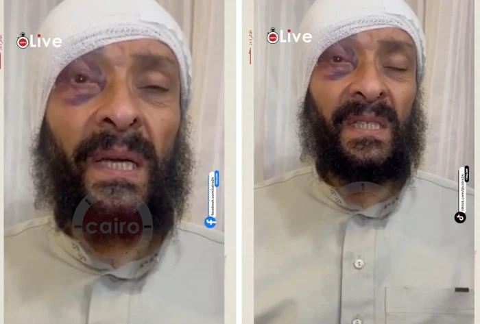 أصيب بنزيف في المخ مرتين.. فيديو جديد للطبيب المصري الذي تعرض للسرقة من قبل أبنائه بعد 30 سنة من العمل في السعودية