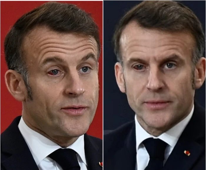 "ماكرون" يظهر بعين منتفخة وحمراء ويثير الجدل