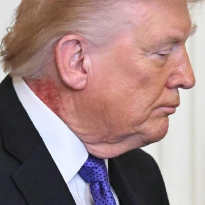 بعد ظهورها سابقا على يديه.. البيت الأبيض يكشف سبب ظهور قشور حمراء على رقبة ترامب!