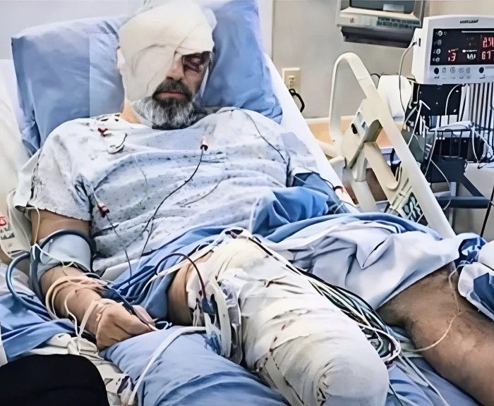 جدل واسع حول صورة  متداولة لـ"مجتبى خامنئي" بقدم مبتورة وعين مصابة