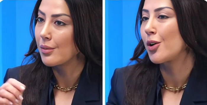 بالفيديو.. خبيرة تكشف وصفة “الحليب الذهبي” لتقليل الالتهابات