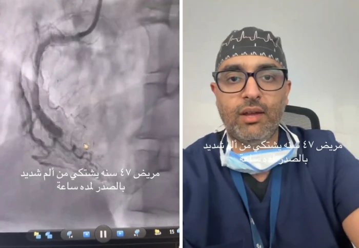 بالفيديو .. استشاري يشرح كيف تُجرى القسطرة القلبية العاجلة لإزالة جلطة وتركيب دعامة لمريض شعر  بألم  في الصدر