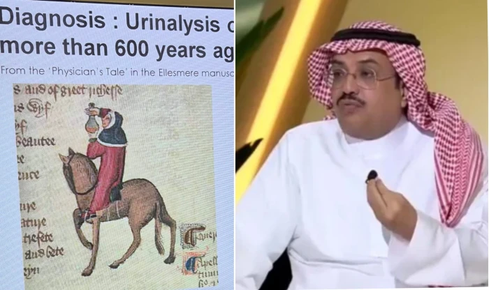 لماذا كان الطبيب قبل أكثر من 600 سنة يسير على ظهر الخيل ومعه قارورة بول؟.. النمر يجيب