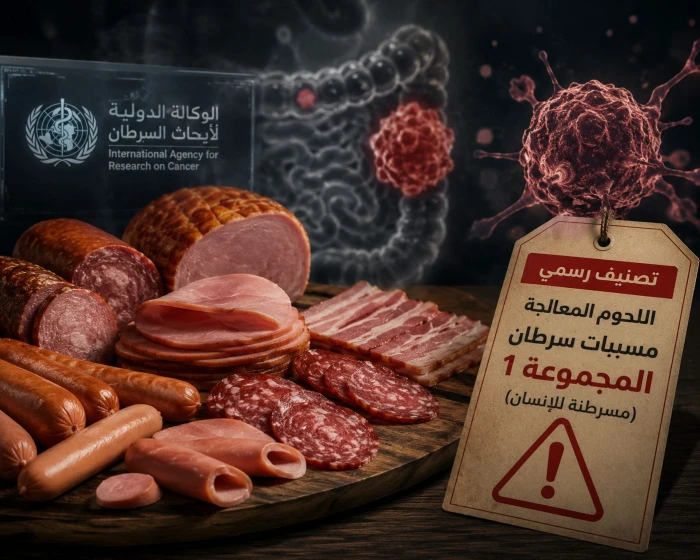 رسميا : تصنيف اللحوم المعالجة كمسببات للإصابة بسرطان القولون والمستقيم