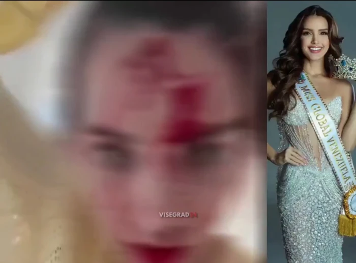 ظهرت ووجهها مغطى بالدماء.. بالفيديو: الاعتداء على ملكة جمال فنزويلا داخل فندق بـمهرجان كان السينمائي