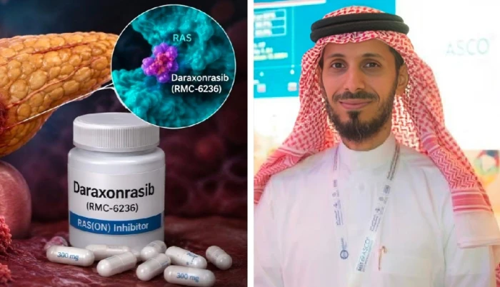 استشاري أورام يكشف تفاصيل علاج ثوري لسرطان البنكرياس.. ويوضح حقيقة توفره