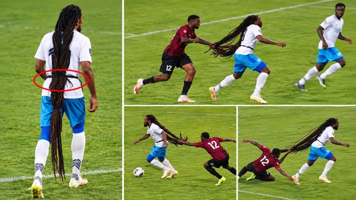 دوري أفريقي.. بالفيديو: شعر لاعب يتسبب في طرد لاعبين من الفريق المنافس!