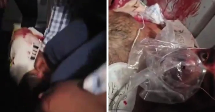 فيديو جديد :  أول ظهور لقائد طائرة «فلاي دبي» ومساعده بعد إصابتهما وهبوط الطائرة اضطراريًا في السعودية