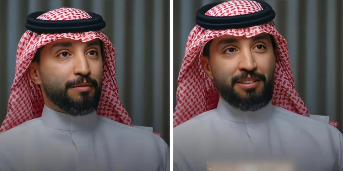 بالفيديو.. استشاري يكشف عن 3 طرق للوقاية من الجلطات بنسبة 90%