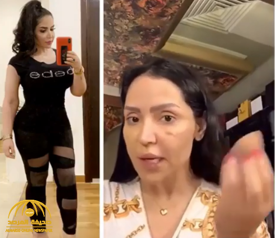 شاهد : فنانة كويتية تصدم جمهورها بظهور جرح عميق على الخد بعد إزالة "الفيلر" !