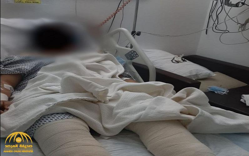 تطورات جديدة في واقعة "دهس شاب" في شوقية مكة.. والده يكشف حالته الصحية و"مفاجأة" بشأن مصير الجاني