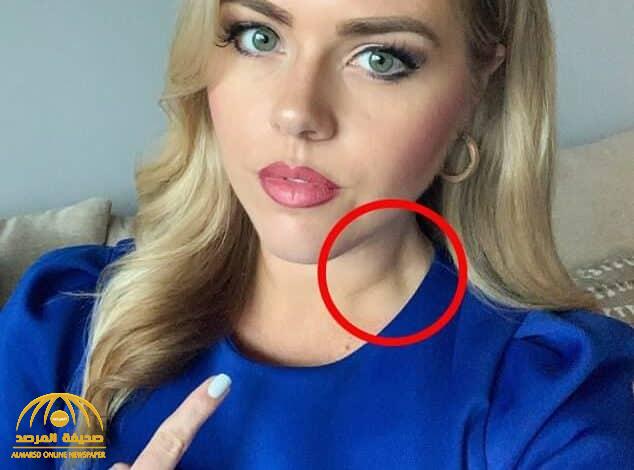 مشاهد يصدم مراسلة أمريكية : أنت مصابة بورم سرطاني في العنق!