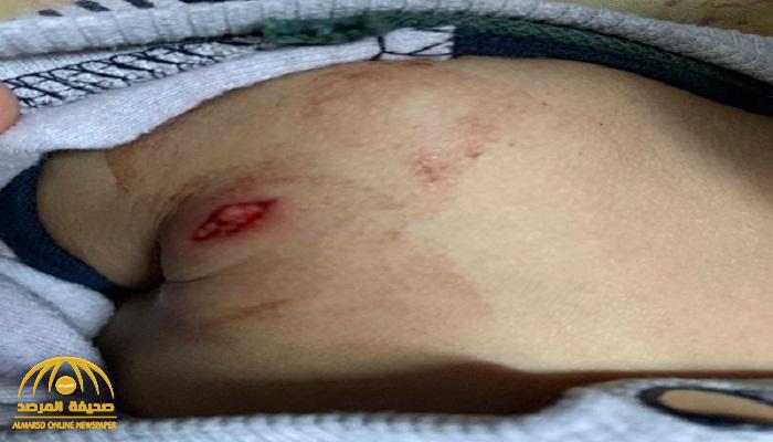 طلقة نارية في حفل زواج تصيب رضيع بجروح خطيرة !