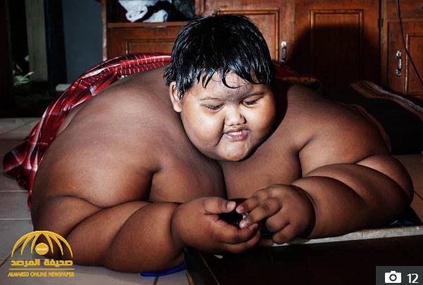 شاهد .. كيف أصبح أسمن طفل في العالم بعدما فقد 115 كيلو من وزنه