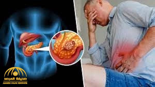 هذه العلامة قد تدل على الإصابة بسرطان البنكرياس!