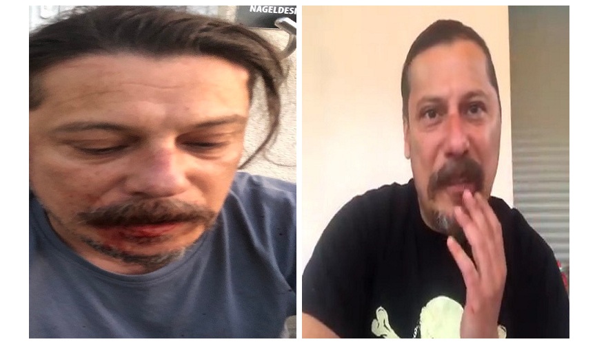 بالفيديو : الاعتداء على صحفي تركي معروف بانتقاده لأردوغان في ألمانيا