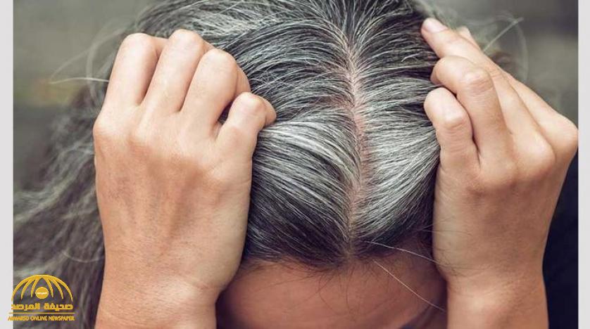 نقص هذا "الفيتامين" يؤدي إلى ظهور الشيب المبكر قبل الأوان