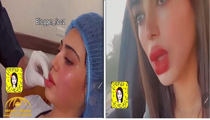 شاهد.. شيلاء سبت تصدم جمهورها في أحدث ظهور لها.. وهكذا علقت