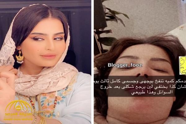 شاهد: بدور البراهيم تصدم متابعيها بصورة لوجهها بعد خضوعها لعملية تجميل شاهد: بدور البراهيم تصدم متابعيها بصورة لوجهها بعد خضوعها لعملية تجميل