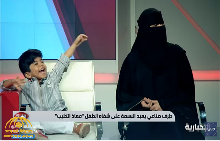 "الحين صار عندي يدين".. شاهد: ردة فعل طفل بعد تركيب طرف صناعي ليده