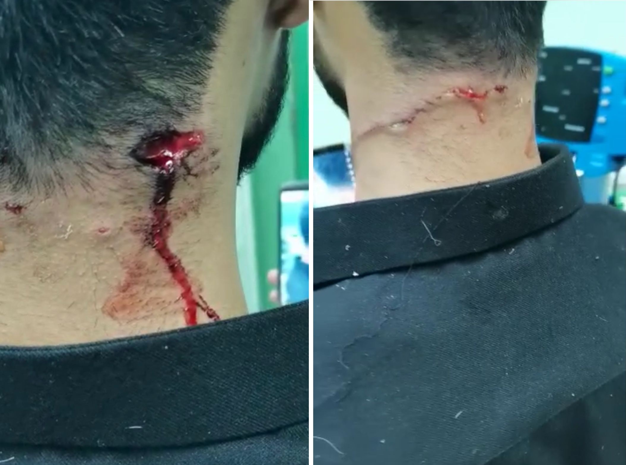 شاهد .. ذئب يفترس صاحبه ويغرس أنيابه في رقبته داخل استراحة بحائل ويعرضه لإصابة خطيرة