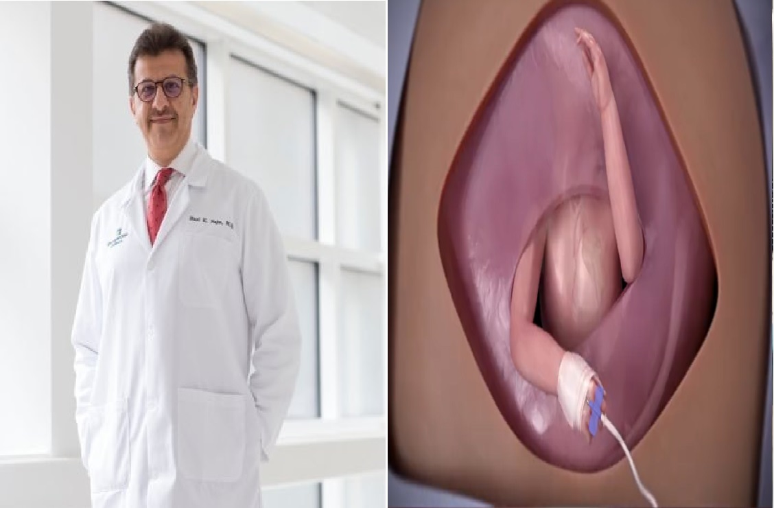 الطبيب السعودي "هاني نجم" يروي تفاصيل الجراحة النادرة التي أجراها لجنين في رحم أمه بأمريكا