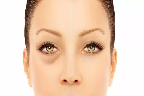 تسبب الانتفاخ والتورم في الوجه.. طبيبة روسية تحذر من تناول هذه الأطعمة!