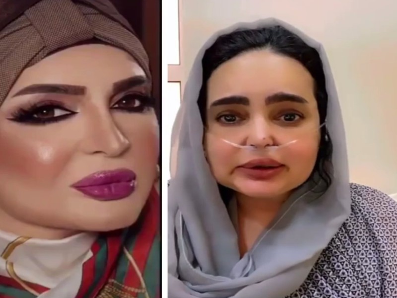 عايشة بنصف رئة.. شاهد: الفنانة بدرية أحمد تكشف تطورات خطيرة  بشأن حالتها الصحية