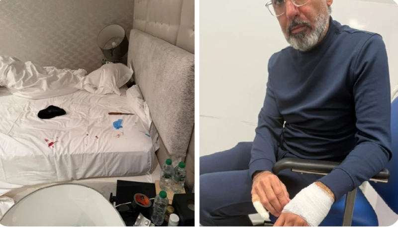 ‏بالصور: محاولة اغتيال رجل الأعمال الكويتي " فواز الحساوي" داخل منزله في لندن