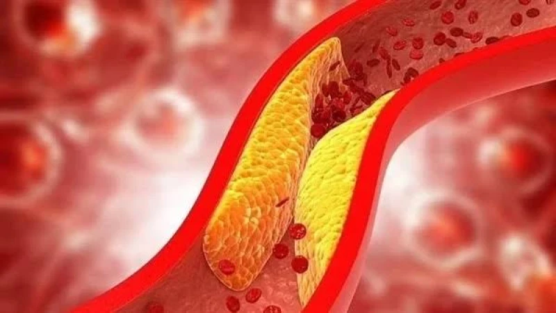 دون أدوية.. تقرير يكشف عن طرق طبيعية فعّالة لخفض الكوليسترول