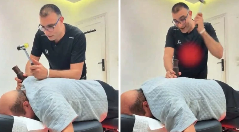 "يا شيخ مريع ليش تصوت فضحتنا بين القبايل".. فيديو طريف للطبيب المصري أبو النصر يعالج مريض سعودي باستخدام المطرقة والأخير يصرخ من الألم