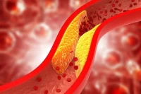 الكشف عن 11 مشروبًا طبيعيًا لخفض الكوليسترول وحماية القلب